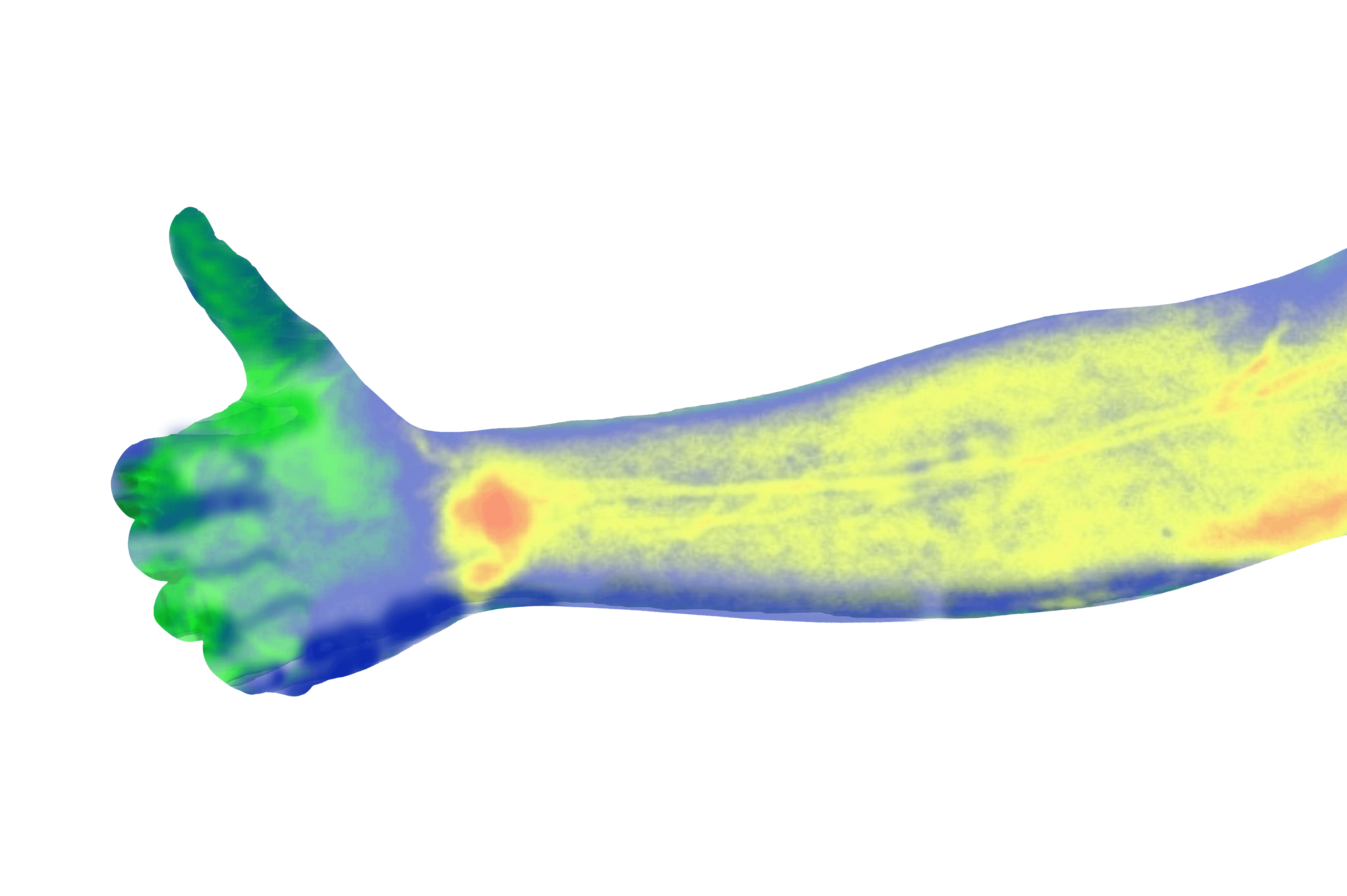 thermal